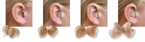 какой слуховой аппарат выбрать, какой купить слуховой аппарат